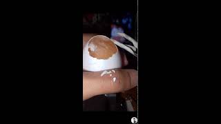 Raw Egg Peeling  shells removalist eggpeel [upl. by Nivat]