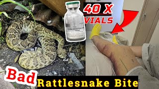 Rattlesnake Bite While Herping Central Texas [upl. by Clower]