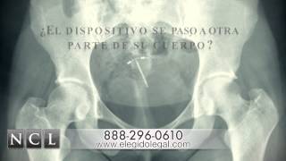 Mirena IUD Injury Law Firm Los Angeles  Spanish Commercial [upl. by Linsk410]