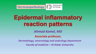 Epidermal inflammatory reaction patterns Dermatopathology [upl. by Akaya]