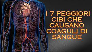 I 7 Peggiori Cibi che Causano Coaguli di Sangue [upl. by Enicar57]