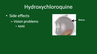 Hydroxychloroquine for Rheumatoid Arthritis [upl. by Kcirret]