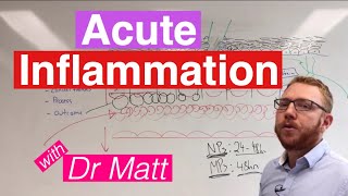 Acute Inflammation  Immunology [upl. by Marybella149]