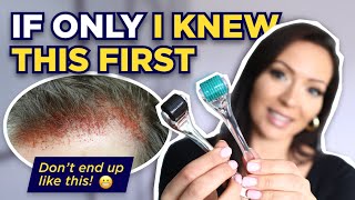 The Dermaroller Watch This BEFORE Microneedling What I wish I knew Before I Started Dermarolling [upl. by Uella]