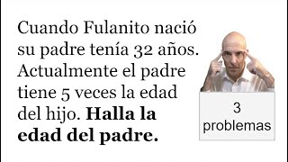 TRES PROBLEMAS DE EDADES ¡El último nadie lo hace [upl. by Neeven]