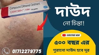 দাউদেরদাদ ও চুলকানির সবচেয়ে ভালো ঔষধ ডেরোবিনडेरोबिन क्रीम किस काम में आता है  দাদের ওষুধ Derobin [upl. by Naivaj68]