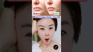 Improve Saggy Cheeks  Face Lift facelift yogafacial yoga facialyoga sagging shorts [upl. by Serafina]