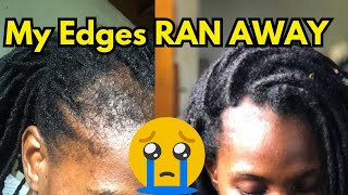 How To Regrow Your Edges Bald Spots And Thinning Hair [upl. by Maise]