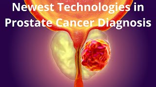 Newest Technologies in Prostate Cancer Diagnosis [upl. by Wendall]