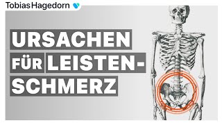 Leistenschmerz ✖️  Ursachen bei Schmerzen in der Leiste [upl. by Atinrehs]