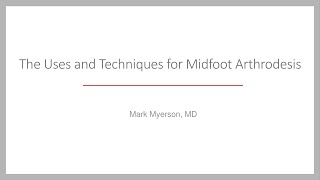 Arthrodesis of the Midfoot [upl. by Lore]