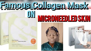 Famous collagen mask on Microneedled skin [upl. by Yrrol473]