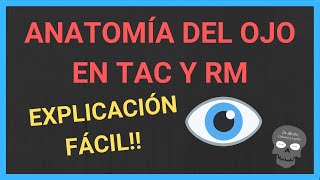 ANATOMÍA OCULAR👁️en TOMOGRAFÍA y RESONANCIA MAGNÉTICA [upl. by Avir99]