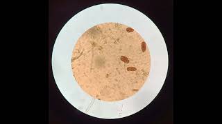 How different Plant Pathogens look under a microscope🔬punjabagriculturaluniversityplantpathology [upl. by Camella]