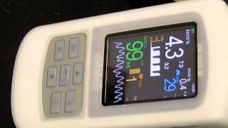 Monitoring of Pulse Oximetry and Capnography in a Cat [upl. by Ilatfan]