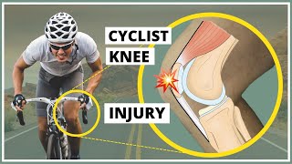 Prepatellar fascia injury also known as Cyclists knee explanation diagnosis and treatment [upl. by Juana]