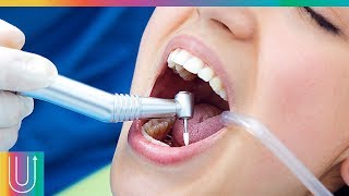 Así los dentistas tapan las caries en los dientes [upl. by Juliana]