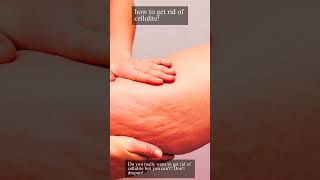 How To Get Rid Of Cellulite cellulitis skincare [upl. by Kovacev]