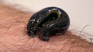 How Leeches are used in Modern Surgery  Earth Science [upl. by Siuqaj]