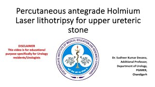 Percutaneous antegrade PCNL Holmium Laser lithotripsy of upper ureteric stone [upl. by Duester]