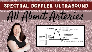 Spectral Doppler Ultrasound All About Arteries [upl. by Bolme]