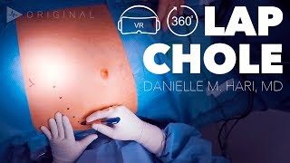 Laparoscopic Cholecystectomy Acute on Chronic Cholecystitis  Dr Danielle Hari [upl. by Yelrah304]