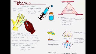 Tetanus Clostridium tetani  Microbio Symptoms Diagnosis Treatment Prevention etc [upl. by Franciskus]