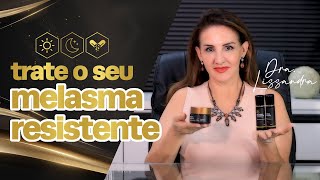 Tratamento INTENSIVO para MELASMA Para quem tem PRESSA [upl. by Namwob750]