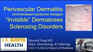 DERMATOPATHOLOGY Perivascular Dermatitis Invisible Dermatoses Fibrosing amp Sclerosing Disorders [upl. by Itaws964]