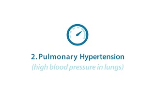 CDH Part 3 CDH Pulmonary Hypertension [upl. by Derr]