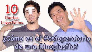 ¿Cómo es el Postoperatorio de una Rinoplastía [upl. by Midge]