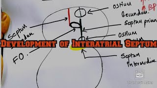 Development of Interatrial SeptumEmbryologyMBBS [upl. by Hardin]