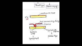 3rd Nerve Palsy  Pupil sparing vs Pupil involving Mustknow Shorts [upl. by Grantham]