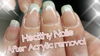 Acrylic Nail Removal  For Healthy Nails [upl. by Bandeen]