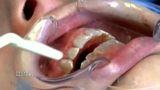 The Doctors Dr Bill Dorfman Transforms Severe Tooth Deterioration [upl. by Anaitsirk]