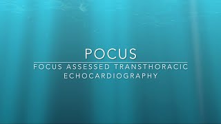 FATE Focus assessed Transthoracic Echocardiography  An essential guide I Focus cardiac ultrasound [upl. by Laspisa]