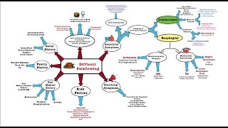 Difficult Swallowing  OSCE [upl. by Sivehc706]