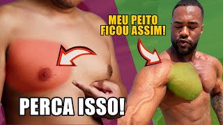 COMO CURAR GINECOMASTIA E PERDER GORDURA NO PEITO [upl. by Esiocnarf]