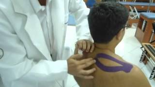 SÍNDROME do IMPACTO do OMBRO TRATAMENTO COM BANDAGEM ELÁSTICA KINESIO TAPE Clínica Dr Robson Sitta [upl. by Nilrak]