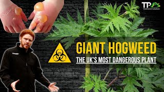 Giant Hogweed  The UKs Most Dangerous amp Toxic Plant [upl. by Imefulo566]