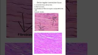 identification of histology slide of dense regular connective tissue anatomy biology histology [upl. by Hsinam]