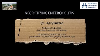 Necrotizing Enterocolitis [upl. by Wystand725]