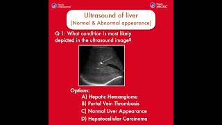 Ultrasound  Ultrasound of liver  Normal amp Abnormal appearance  Flashcard 1  StudyULTRASOUND [upl. by Sherye]