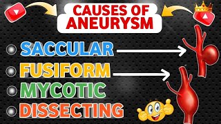 Understanding  Causes Of Aneurysm 😍 [upl. by Irra]