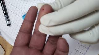 ब्लड शुगर कैसे करते How to test your blood sugar  Glucometer testing procedure  bloodtest suger [upl. by Mohammed]