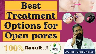 How to treat OPEN PORES  Enlarged Pores  Laser Options  Redefine Plastic Surgery Center [upl. by Ettelracs]