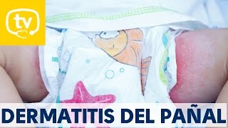 Soluciones para tratar la dermatitis del pañal [upl. by Nomael]