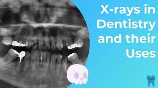 Types of Dental Xrays you NEED to know  Dental Radiographs and Why we use them [upl. by Enoob576]