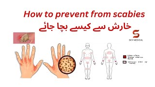 HOW TO PREVENT SCABIES خارش سے کیسے بچا جائے EASY TO UNDERSTAND [upl. by Inacana]