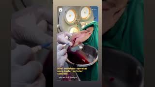 Aural hematoma operation using Buster Haematoma compress lykapetclinicdindigul [upl. by Aleakam]